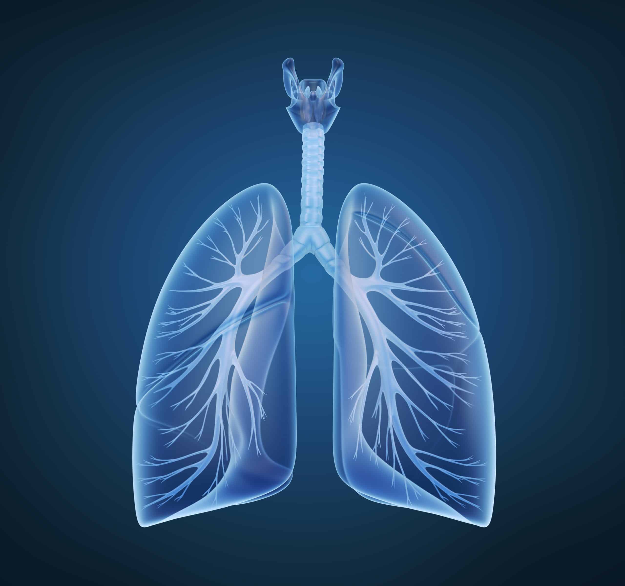 pneumonia-pathophysiology-nursestudy-net