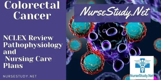 Colon Cancer Pathophysiology Podcast And Nursing Care Plan