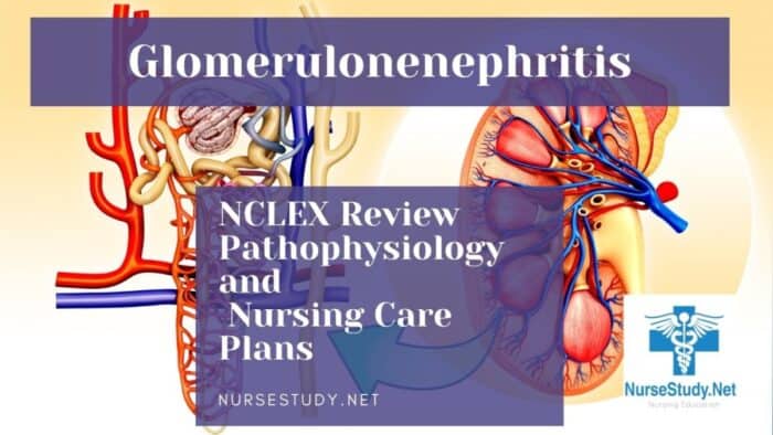 Acute Glomerulonephritis Nursing Diagnosis & Care Plan - NurseStudy.Net