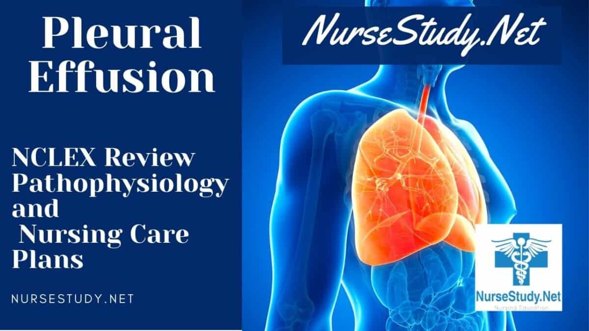 pleural-effusion-types