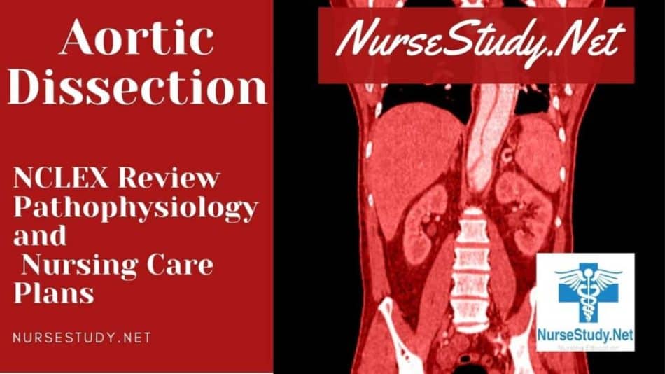 nursing diagnosis for aortic dissection