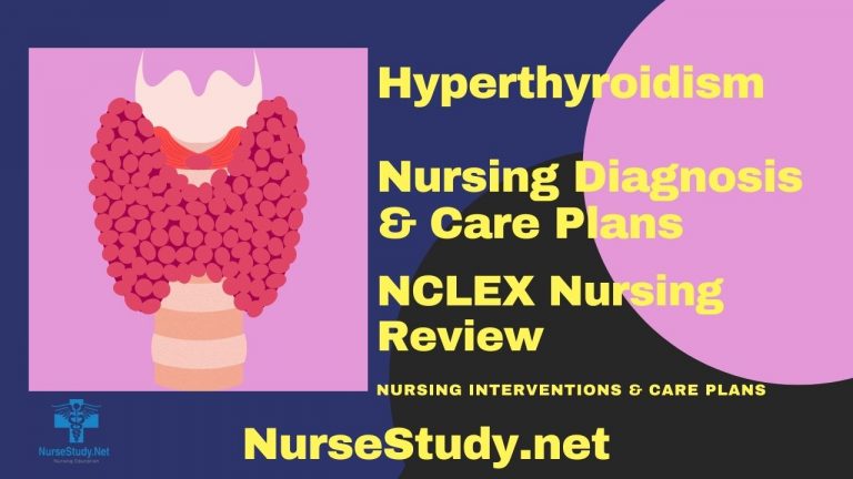 hyperthyroidism case study nursing