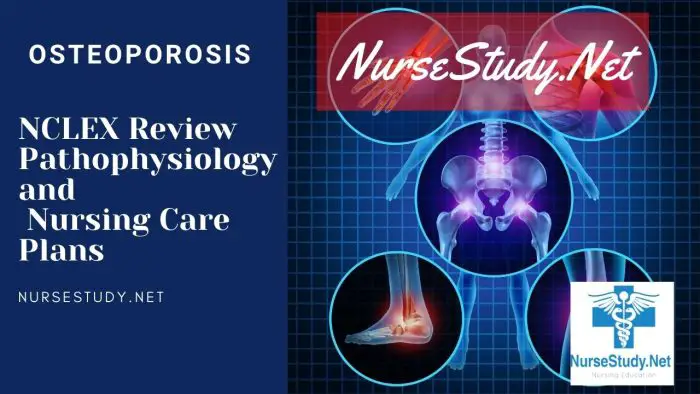 Osteoporosis Nursing Diagnosis Interventions and Care Plans ...