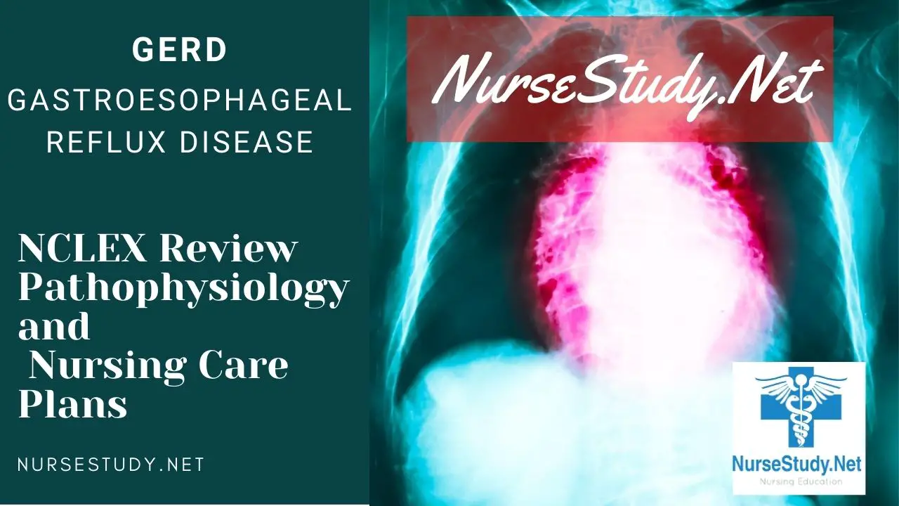 Gastroesophageal reflux disease GERD