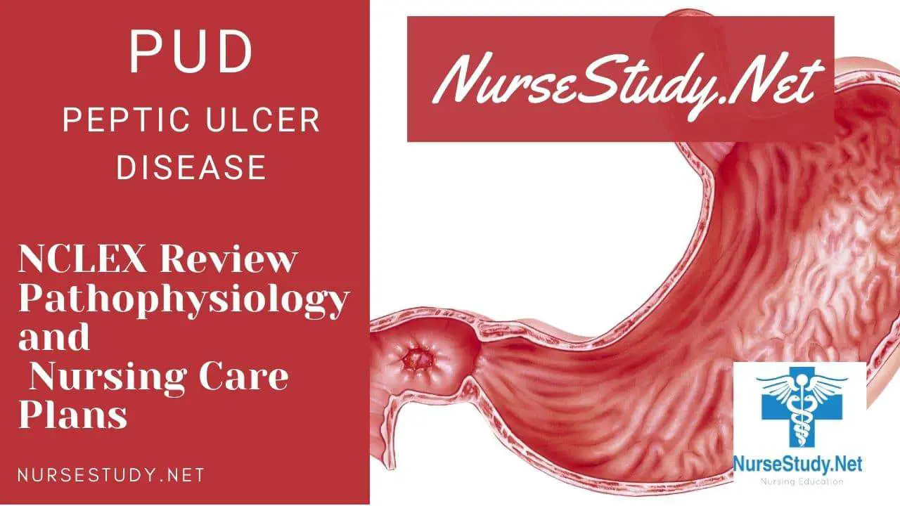 nursing diagnosis for peptic ulcer