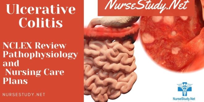 Ulcerative Colitis Nursing Care Plans And Review