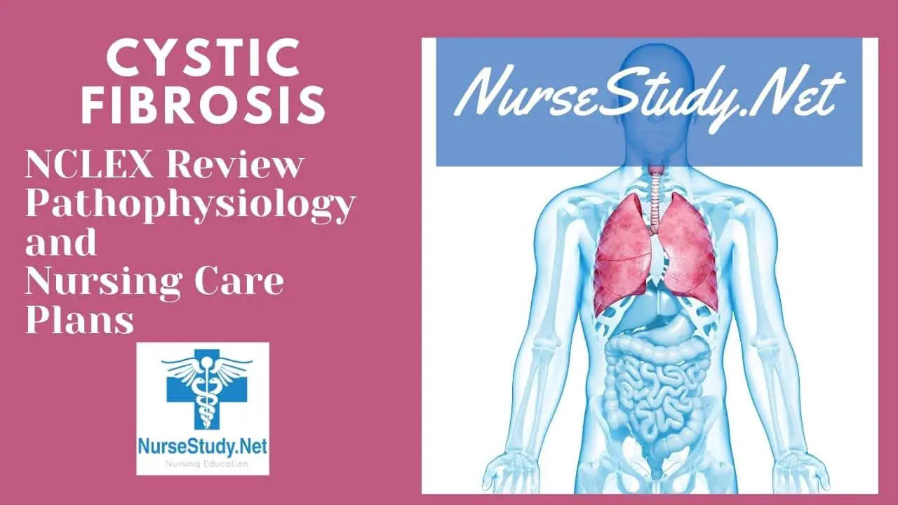 cystic fibrosis evolve hesi case study