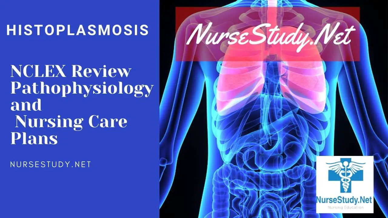 Histoplasmosis Nursing Diagnosis