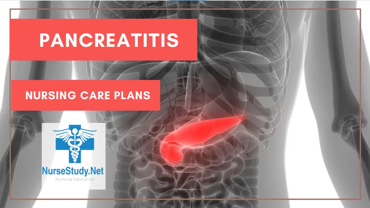 Nurse Study Net — Nursing Care Plans for Pancreatitis