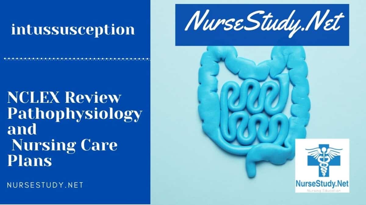 Intussusception Nursing Diagnosis