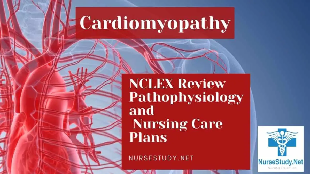 cardiomyopathy treatment