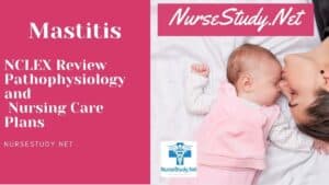mastitis nursing diagnosis