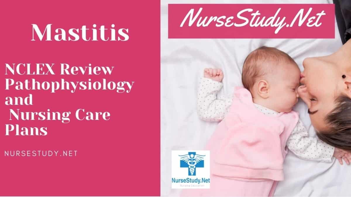 Mastitis Nursing Care Plans And Diagnosis Interventions NurseStudy Net