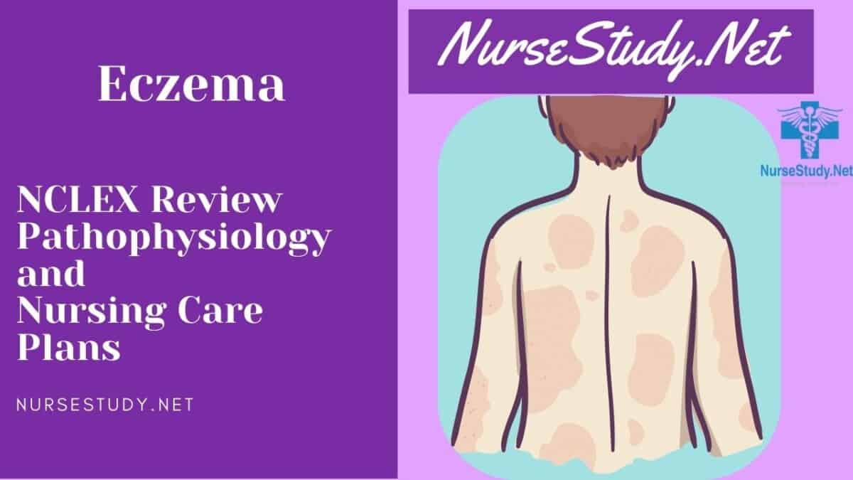 nursing diagnosis for eczema
