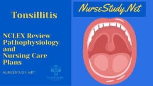 Tonsillitis Nursing Diagnosis