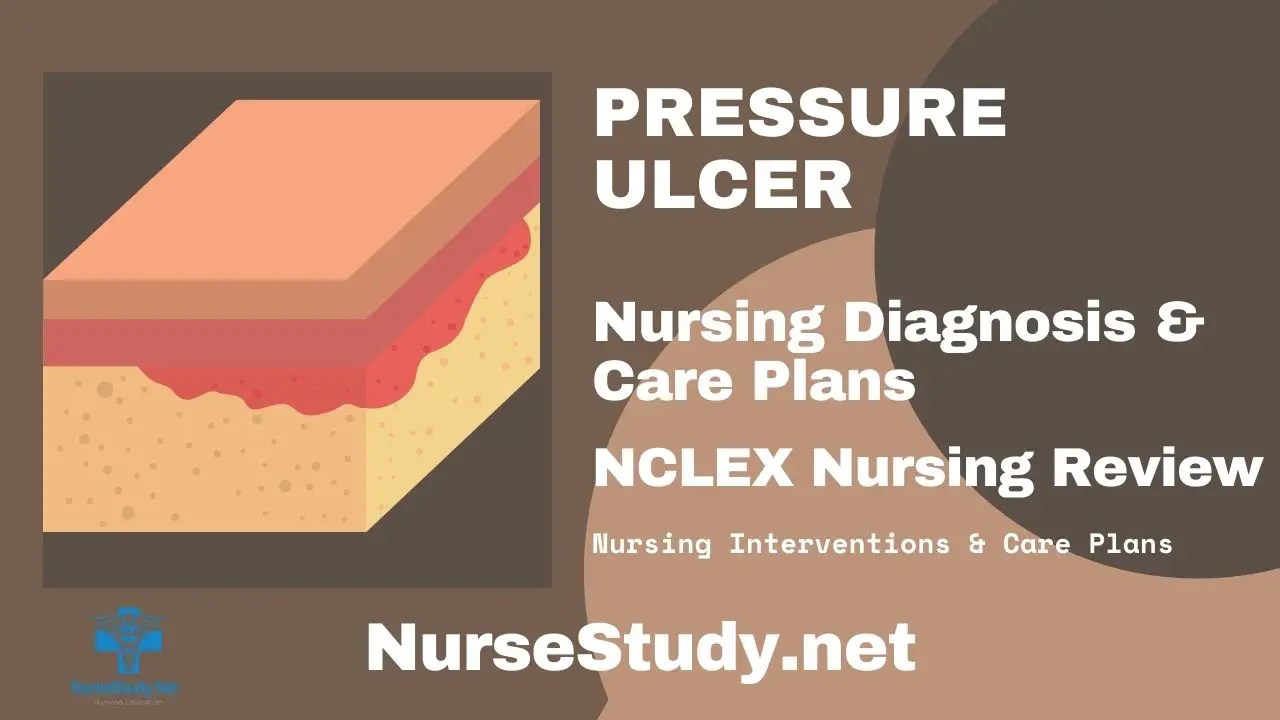 nursing diagnosis for pressure ulcer