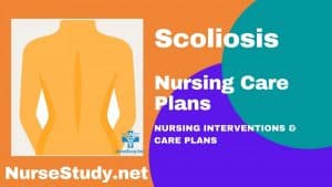Scoliosis Nursing Diagnosis