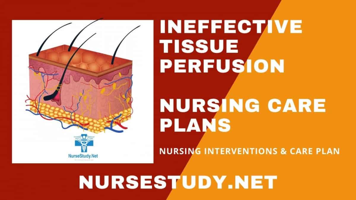 ineffective tissue perfusion nursing diagnosis