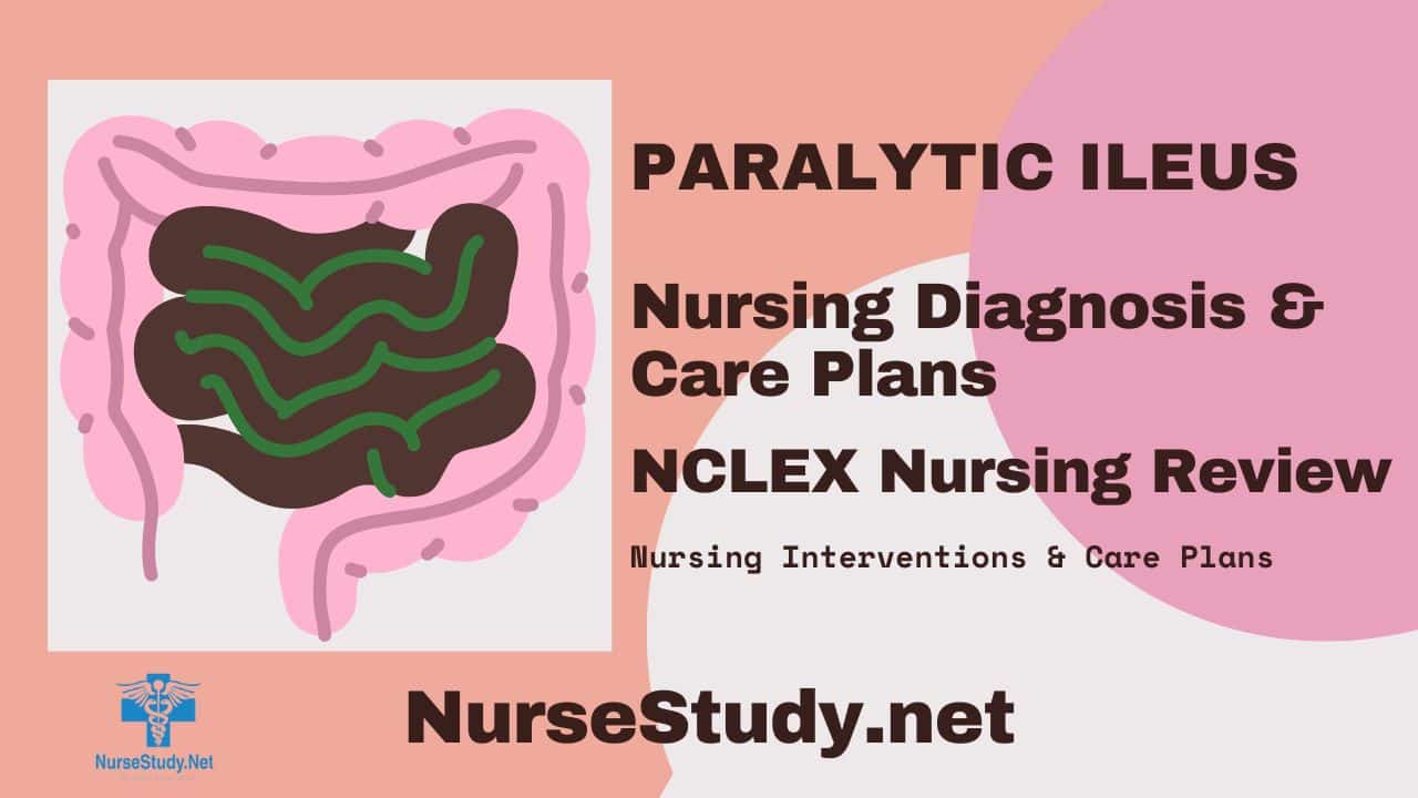 nursing diagnosis paralytic ileus