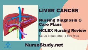 liver cancer nursing diagnosis