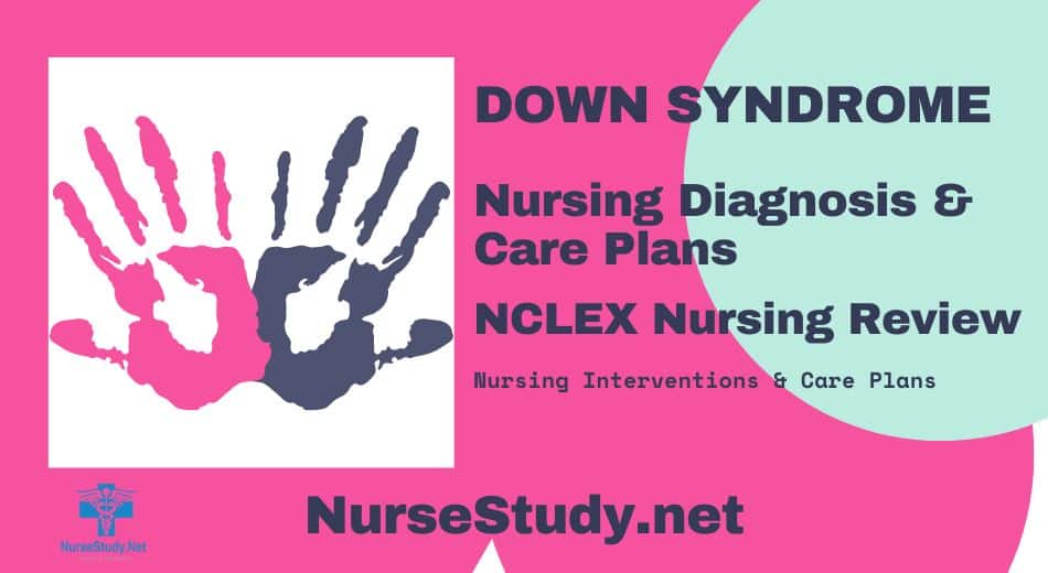 nursing diagnosis for down syndrome