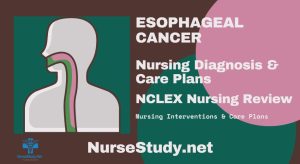 nursing diagnosis for esophageal cancer