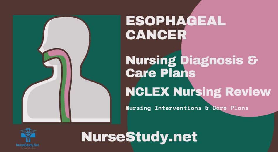 nursing diagnosis for esophageal cancer