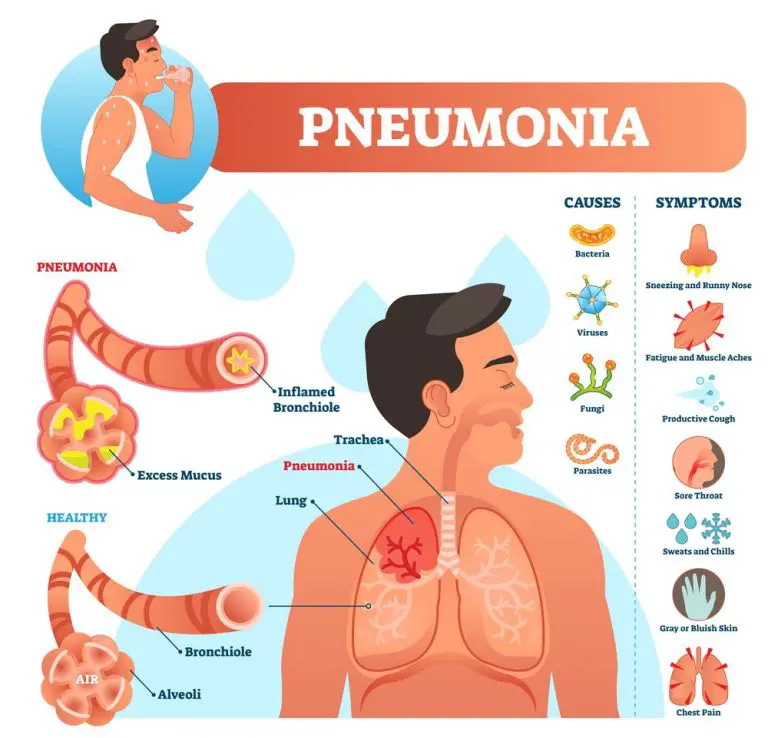 Pneumonia Nursing Diagnosis and Care Plan