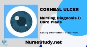 Nursing Diagnosis for corneal Ulcer